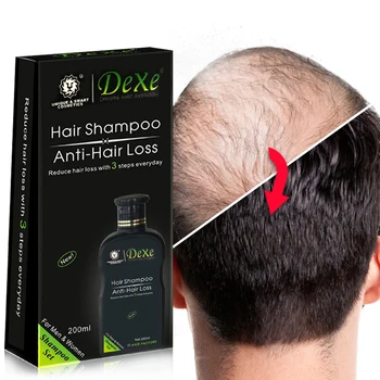 200ml Dexe Juuksed Anti hair loss Shampoo Hiina Taimne Juuste Kasvu Toode Vältida Juuste Ravi Meestele & Naistele tasuta saatmine